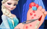 Elsa Ayak Ameliyatı